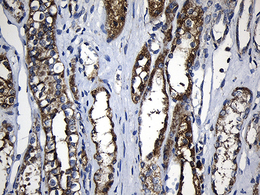 PCCA Antibody - Immunohistochemical staining of paraffin-embedded Human Kidney tissue within the normal limits using anti-PCCA mouse monoclonal antibody. (Heat-induced epitope retrieval by 1mM EDTA in 10mM Tris buffer. (pH8.5) at 120°C for 3 min. (1:500)