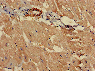 PCCA Antibody - Immunohistochemistry of paraffin-embedded human heart tissue at dilution of 1:100