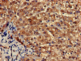 PCCA Antibody - Immunohistochemistry of paraffin-embedded human liver tissue at dilution of 1:100