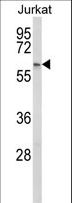 PCCB Antibody - Western blot of PCCB Antibody in Jurkat cell line lysates (35 ug/lane). PCCB (arrow) was detected using the purified antibody.