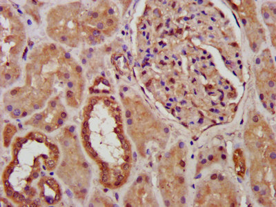 PCCB Antibody - Immunohistochemistry image at a dilution of 1:300 and staining in paraffin-embedded human kidney tissue performed on a Leica BondTM system. After dewaxing and hydration, antigen retrieval was mediated by high pressure in a citrate buffer (pH 6.0) . Section was blocked with 10% normal goat serum 30min at RT. Then primary antibody (1% BSA) was incubated at 4 °C overnight. The primary is detected by a biotinylated secondary antibody and visualized using an HRP conjugated SP system.