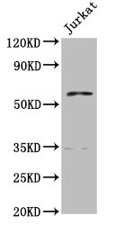PCCB Antibody - Positive Western Blot detected in Jurkat whole cell lysate. All lanes: PCCB antibody at 7.7 µg/ml Secondary Goat polyclonal to rabbit IgG at 1/50000 dilution. Predicted band size: 59, 61 KDa. Observed band size: 59 KDa