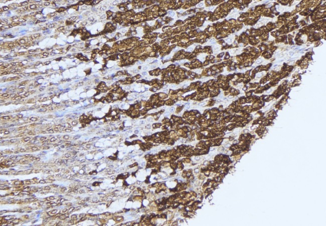 PCCB Antibody - 1:100 staining human gastric tissue by IHC-P. The sample was formaldehyde fixed and a heat mediated antigen retrieval step in citrate buffer was performed. The sample was then blocked and incubated with the antibody for 1.5 hours at 22°C. An HRP conjugated goat anti-rabbit antibody was used as the secondary.