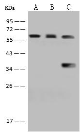 PCCB Antibody - Anti-PCCB rabbit polyclonal antibody at 1:500 dilution. Lane A: HepG2 Whole Cell Lysate. Lane B: 293T Whole Cell Lysate. Lane C: Jurkat Whole Cell Lysate. Lysates/proteins at 30 ug per lane. Secondary: Goat Anti-Rabbit IgG (H+L)/HRP at 1/10000 dilution. Developed using the ECL technique. Performed under reducing conditions. Predicted band size: 58 kDa. Observed band size: 58 kDa.