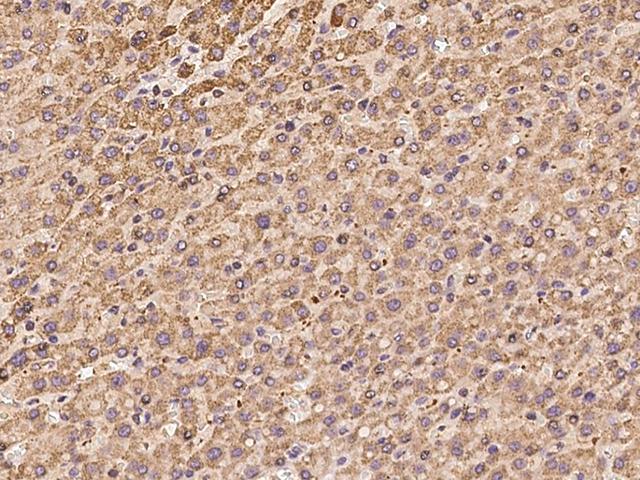 PCCB Antibody - Immunochemical staining of human PCCB in human liver with rabbit polyclonal antibody at 1:100 dilution, formalin-fixed paraffin embedded sections.