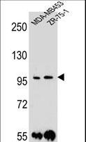 PCDH1 / PCD1 Antibody - PCDH1 Antibody western blot of MDA-MB453,ZR-75-1 cell line lysates (35 ug/lane). The PCDH1 antibody detected the PCDH1 protein (arrow).