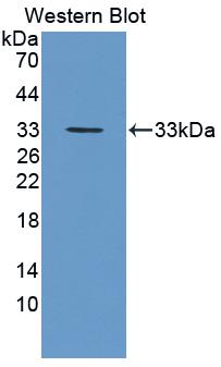 PCDH1 / PCD1 Antibody - Western blot of PCDH1 / PCD1 antibody.