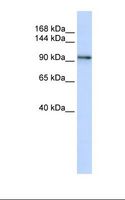 PCDH1 / PCD1 Antibody - MCF7 cell lysate. Antibody concentration: 1.0 ug/ml. Gel concentration: 6-18%.  This image was taken for the unconjugated form of this product. Other forms have not been tested.