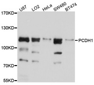 PCDH1 / PCD1 Antibody - Western blot analysis of extracts of various cell lines, using PCDH1 antibody at 1:1000 dilution. The secondary antibody used was an HRP Goat Anti-Rabbit IgG (H+L) at 1:10000 dilution. Lysates were loaded 25ug per lane and 3% nonfat dry milk in TBST was used for blocking. An ECL Kit was used for detection and the exposure time was 5s.