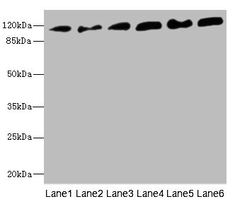 PCDH1 / PCD1 Antibody - Western blot All Lanes: PCDH1 antibody at 2.56ug/ml Lane 1: A431 whole cell lysate Lane 2: Human breast cancer cell Lane 3: Jurkat whole cell lysate Lane 4: Hela whole cell lysate Lane 5: NIH/3T3 whole cell lysate Lane 6: 293T whole cell lysate Secondary Goat polyclonal to rabbit IgG at 1/10000 dilution Predicted band size: 115,134 kDa Observed band size: 115 kDa