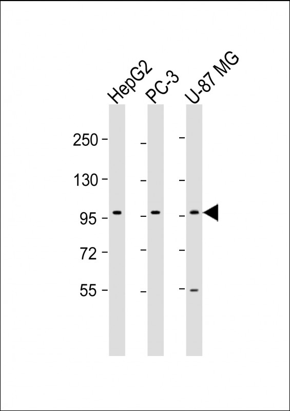 PCDH10 Antibody - All lanes: Anti-PCDH10 Antibody (N-Term) at 1:1000-1:2000 dilution. Lane 1: HepG2 whole cell lysate. Lane 2: PC-3 whole cell lysate. Lane 3: U-87 MG whole cell lysate Lysates/proteins at 20 ug per lane. Secondary Goat Anti-Rabbit IgG, (H+L), Peroxidase conjugated at 1:10000 dilution. Predicted band size: 113 kDa. Blocking/Dilution buffer: 5% NFDM/TBST.