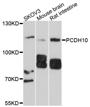 PCDH10 Antibody - Western blot analysis of extracts of various cell lines, using PCDH10 antibody at 1:1000 dilution. The secondary antibody used was an HRP Goat Anti-Rabbit IgG (H+L) at 1:10000 dilution. Lysates were loaded 25ug per lane and 3% nonfat dry milk in TBST was used for blocking. An ECL Kit was used for detection and the exposure time was 60s.