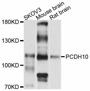 PCDH10 Antibody - Western blot analysis of extracts of various cell lines, using PCDH10 antibody at 1:3000 dilution. The secondary antibody used was an HRP Goat Anti-Rabbit IgG (H+L) at 1:10000 dilution. Lysates were loaded 25ug per lane and 3% nonfat dry milk in TBST was used for blocking. An ECL Kit was used for detection and the exposure time was 5s.