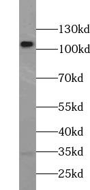 PCDH10 Antibody - PC-3 cells were subjected to SDS PAGE followed by western blot with PCDH10 antibody at dilution of 1:300