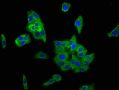 PCDH11X / Protocadherin 11 Antibody - Immunofluorescence staining of HepG2 cells at a dilution of 1:166, counter-stained with DAPI. The cells were fixed in 4% formaldehyde, permeabilized using 0.2% Triton X-100 and blocked in 10% normal Goat Serum. The cells were then incubated with the antibody overnight at 4 °C.The secondary antibody was Alexa Fluor 488-congugated AffiniPure Goat Anti-Rabbit IgG (H+L) .