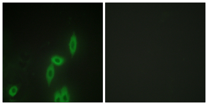 PCDH11X+Y Antibody - Immunofluorescence analysis of HepG2 cells, using PCDH-X/Y Antibody. The picture on the right is blocked with the synthesized peptide.