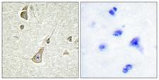 PCDH11X+Y Antibody - Immunohistochemistry analysis of paraffin-embedded human brain tissue, using PCDH-X/Y Antibody. The picture on the right is blocked with the synthesized peptide.