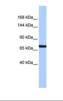 PCDH15 Antibody - HepG2 cell lysate. Antibody concentration: 1.0 ug/ml. Gel concentration: 6%-18%.  This image was taken for the unconjugated form of this product. Other forms have not been tested.