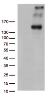 PCDH15 Antibody - HEK293T cells were transfected with the pCMV6-ENTRY control. (Left lane) or pCMV6-ENTRY PCDH15. (Right lane) cDNA for 48 hrs and lysed. Equivalent amounts of cell lysates. (5 ug per lane) were separated by SDS-PAGE and immunoblotted with anti-PCDH15. (1:500)