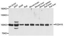 PCDH15 Antibody - Western blot analysis of extracts of various cell lines, using PCDH15 antibody at 1:1000 dilution. The secondary antibody used was an HRP Goat Anti-Rabbit IgG (H+L) at 1:10000 dilution. Lysates were loaded 25ug per lane and 3% nonfat dry milk in TBST was used for blocking. An ECL Kit was used for detection and the exposure time was 5s.