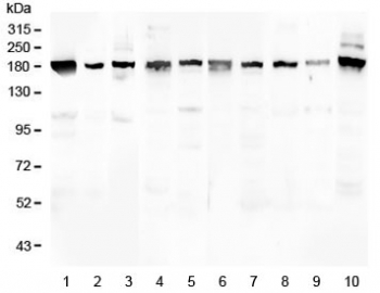 PCDH15 Antibody - Western blot testing of 1) human placenta 2) human U-2 OS, 3) human HeLa, 4) rat brain, 5) rat lung, 6) mouse brain, 7) mouse lung, 8) mouse kidney, 9) mouse spleen and 10) mouse Neuro-2a lysate with PCDH15 antibody at 0.5ug/ml. Isoforms have been observed with molecular weights of: 250, 180, 160, 130, 90 and 60 kDa.