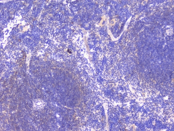 PCDH15 Antibody - IHC staining of FFPE mouse spleen with PCDH15 antibody at 1ug/ml. HIER: boil tissue sections in pH6, 10mM citrate buffer, for 10-20 min followed by cooling at RT for 20 min.