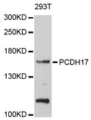 PCDH17 Antibody - Western blot analysis of extracts of 293T cells, using PCDH17 antibody at 1:1000 dilution. The secondary antibody used was an HRP Goat Anti-Rabbit IgG (H+L) at 1:10000 dilution. Lysates were loaded 25ug per lane and 3% nonfat dry milk in TBST was used for blocking. An ECL Kit was used for detection and the exposure time was 60s.