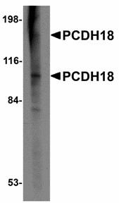 PCDH18 Antibody - Western blot of PCDH18 in Raji cell lysate with PCDH18 antibody at 2 ug/ml. Below: Immunohistochemistry of PCDH18 in mouse brain tissue with PCDH18 antibody at 2.5 ug/ml.