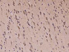 PCDH18 Antibody - Immunochemical staining of human PCDH18 in human brain with rabbit polyclonal antibody at 1:100 dilution, formalin-fixed paraffin embedded sections.