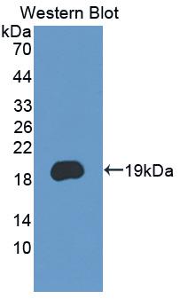 PCDH20 Antibody - Western blot of PCDH20 antibody.