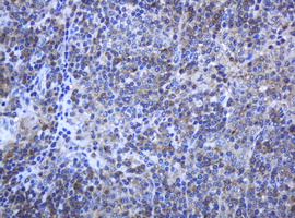 PCDH7 Antibody - IHC of paraffin-embedded Human lymphoma tissue using anti-PCDH7 mouse monoclonal antibody. (Heat-induced epitope retrieval by 10mM citric buffer, pH6.0, 120°C for 3min).