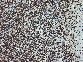 PCDH7 Antibody - IHC of paraffin-embedded Human Ovary tissue using anti-PCDH7 mouse monoclonal antibody. (Heat-induced epitope retrieval by 10mM citric buffer, pH6.0, 100C for 10min).