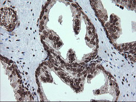 PCDH7 Antibody - IHC of paraffin-embedded Human prostate tissue using anti-PCDH7 mouse monoclonal antibody. (Heat-induced epitope retrieval by 10mM citric buffer, pH6.0, 100C for 10min).