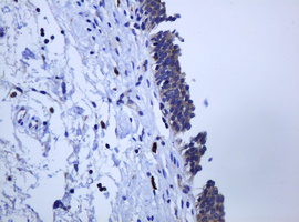 PCDH7 Antibody - IHC of paraffin-embedded Human bladder tissue using anti-PCDH7 mouse monoclonal antibody.