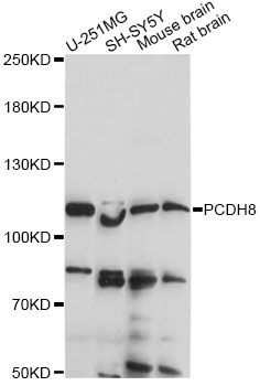 PCDH8 Antibody - Western blot analysis of extracts of various cell lines, using PCDH8 antibody at 1:1000 dilution. The secondary antibody used was an HRP Goat Anti-Rabbit IgG (H+L) at 1:10000 dilution. Lysates were loaded 25ug per lane and 3% nonfat dry milk in TBST was used for blocking. An ECL Kit was used for detection and the exposure time was 90s.