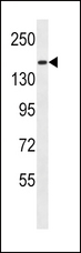 PCDH9 Antibody - PCDH9 Antibody western blot of MDA-MB435 cell line lysates (35 ug/lane). The PCDH9 antibody detected the PCDH9 protein (arrow).