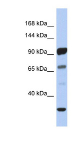 PCDHA10 Antibody - PCDHA10 antibody Western blot of Fetal Stomach lysate. This image was taken for the unconjugated form of this product. Other forms have not been tested.