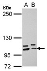 PCDHA10 Antibody - Sample (30 ug of whole cell lysate) A: U87-MG B: SK-N-SH 5% SDS PAGE PCDHA10 antibody diluted at 1:2000