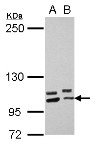 PCDHA10 Antibody - Sample (30 ug of whole cell lysate) A: U87-MG B: SK-N-SH 5% SDS PAGE PCDHA10 antibody diluted at 1:2000