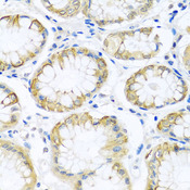 PCDHA12 Antibody - Immunohistochemistry of paraffin-embedded human stomach tissue.