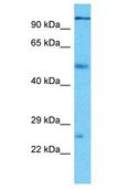 PCDHA3 Antibody - PCDHA3 antibody Western Blot of Thymus Tumor. Antibody dilution: 1 ug/ml.  This image was taken for the unconjugated form of this product. Other forms have not been tested.