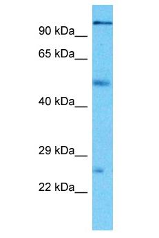 PCDHA3 Antibody - PCDHA3 antibody Western Blot of Thymus Tumor. Antibody dilution: 1 ug/ml.  This image was taken for the unconjugated form of this product. Other forms have not been tested.