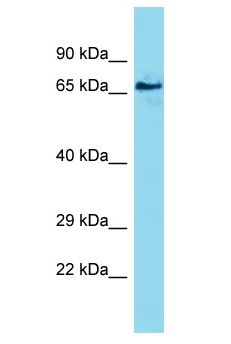 PCDHA6 Antibody - PCDHA6 antibody Western Blot of Stomach Tumor. Antibody dilution: 1 ug/ml.  This image was taken for the unconjugated form of this product. Other forms have not been tested.