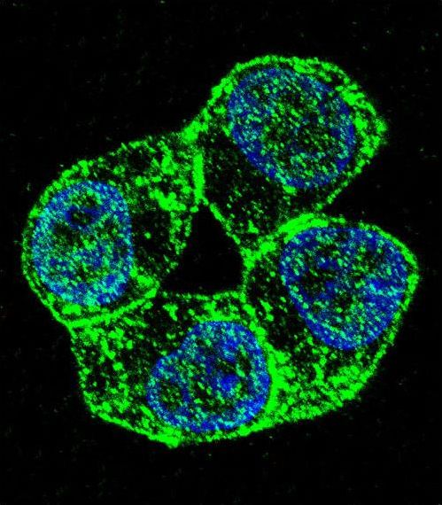 PCDHA8 Antibody - Confocal immunofluorescence of PCDHA8 Antibody with ZR-75-1 cell followed by Alexa Fluor 488-conjugated goat anti-rabbit lgG (green). DAPI was used to stain the cell nuclear (blue).