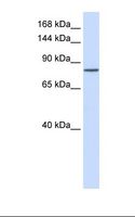 PCDHAC1 Antibody - Fetal lung lysate. Antibody concentration: 1.0 ug/ml. Gel concentration: 6-18%.  This image was taken for the unconjugated form of this product. Other forms have not been tested.