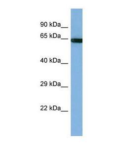 PCDHB14 Antibody - Western blot of Human HT1080 Whole cell . PCDHB14 antibody dilution 1.0 ug/ml.  This image was taken for the unconjugated form of this product. Other forms have not been tested.