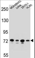 PCDHB15 Antibody - PCDHB15 Antibody western blot of MDA-MB453,Jurkat,ZR-75-1,HL-60 cell line lysates (35 ug/lane). The PCDHB15 antibody detected the PCDHB15 protein (arrow).