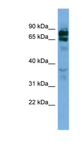 PCDHB16 Antibody - PCDHB16 antibody Western blot of Jurkat lysate. This image was taken for the unconjugated form of this product. Other forms have not been tested.