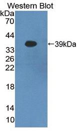 PCDHB16 Antibody - Western blot of PCDHB16 antibody.