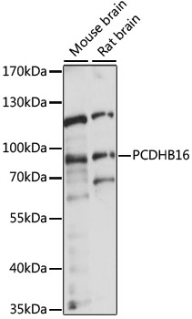 PCDHB16 Antibody - Western blot analysis of extracts of various cell lines, using PCDHB16 antibody at 1:1000 dilution. The secondary antibody used was an HRP Goat Anti-Rabbit IgG (H+L) at 1:10000 dilution. Lysates were loaded 25ug per lane and 3% nonfat dry milk in TBST was used for blocking. An ECL Kit was used for detection and the exposure time was 5s.